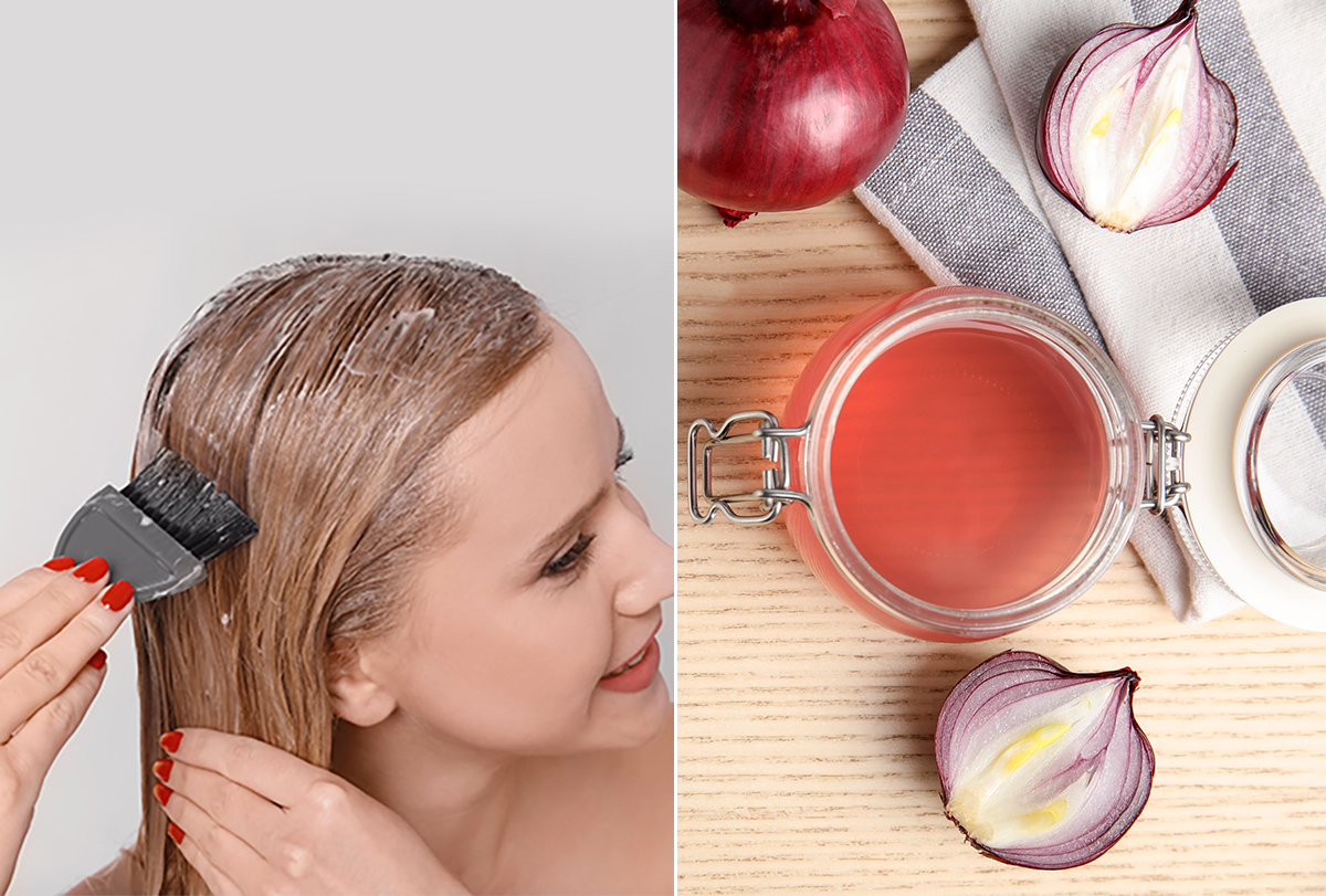 onion juice and honey for hair loss